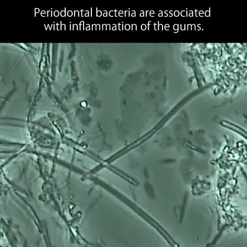 歯周病を顕微鏡で観察